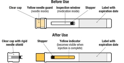 Figure 1 (Exdensur Spl Graphic 01)