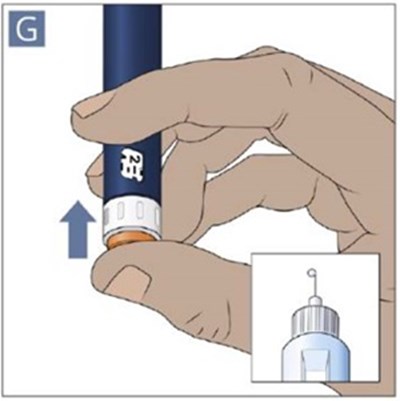 Figure G (Ifu Pen Figure G)