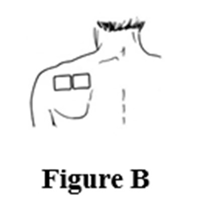 Figure B - figure b