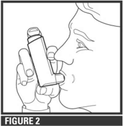Figure 2 (Xop00 0004 04)