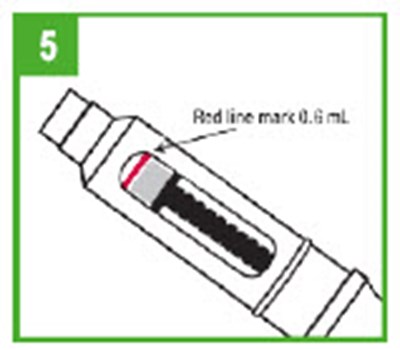 Step 5 (Apokyn 15)