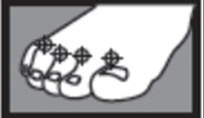 terbinafine-01.jpg Figure - terbinafine 01