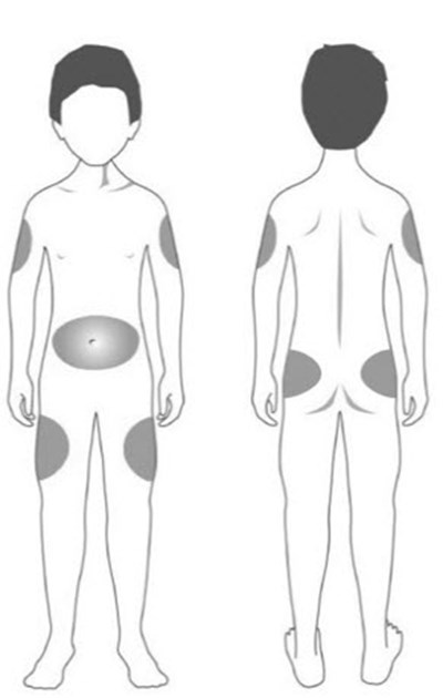 Figure (Strensiq 09)
