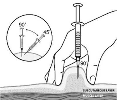 Figure (Strensiq 11)