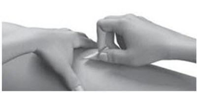 Figure (Strensiq 13)