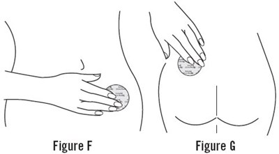 Instructions For Use Figures F And G (Image 10)