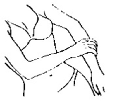 Figure-e (Figure E)