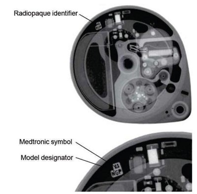 manual-figure1.jpg Figure 1 - manual figure1