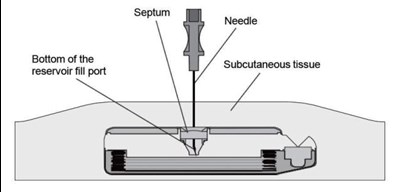 manual-figure6.jpg Figure 6 - manual figure6
