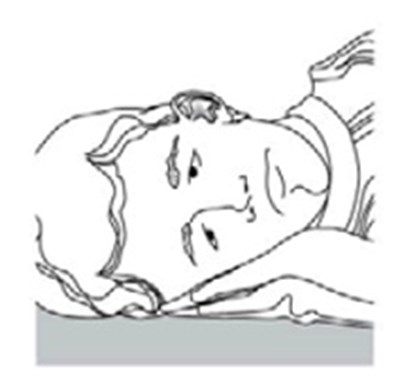 Figure C (Spl Figure B)