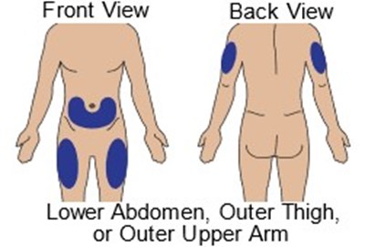 gvoke-vialdx-glucagon-injection-44.jpg Gvoke Kit Figure J - gvoke vialdx glucagon injection 44