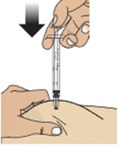 gvoke-vialdx-glucagon-injection-48.jpg Gvoke Kit Figure N - gvoke vialdx glucagon injection 48