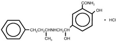 111 - labetalol structure