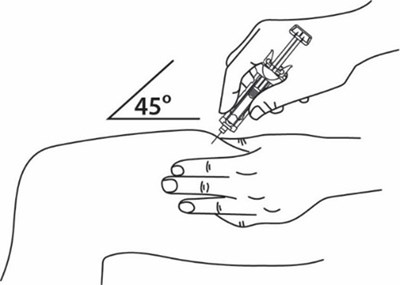 Figure F (Imuldosa 06)