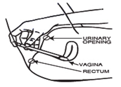 Figure (Terconazole 04)
