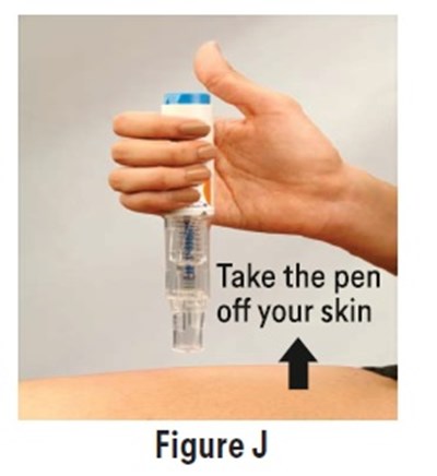fig11.jpg fig11 - fig11