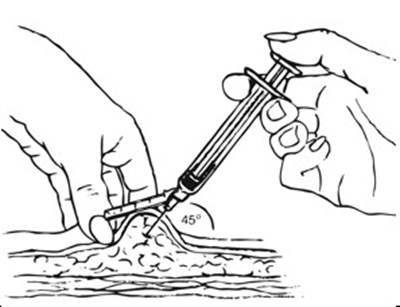 Figure J (Depo Subq Provera 10)