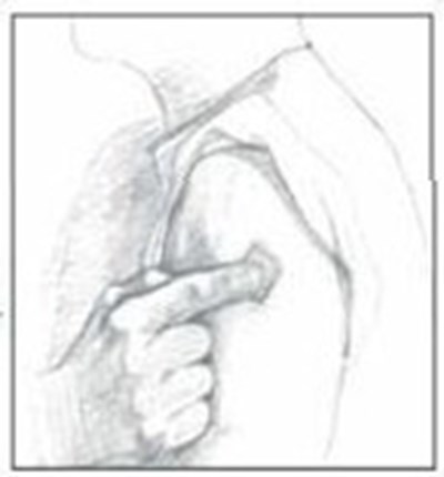 Figure_5 (Figure 5)