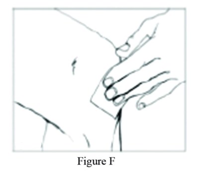 F (Figf)