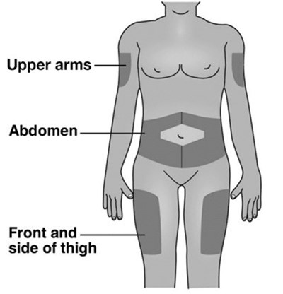 Places to inject - image 09