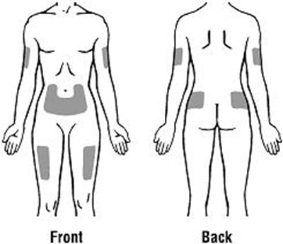 Figure 11 - retacrit 13