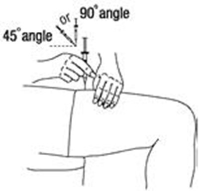 Figure 14 - retacrit 16
