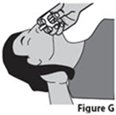 Ifu Figure G (Image 10)