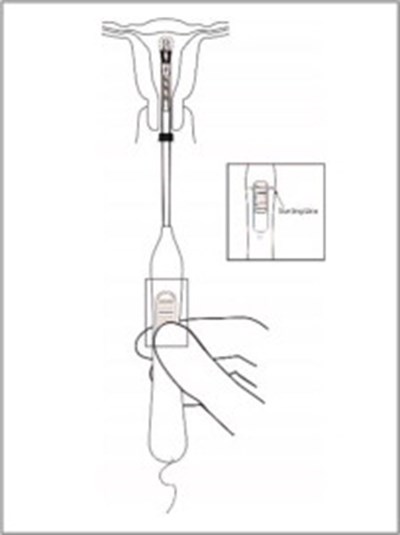 Figure 7 (Par07 0000 07)