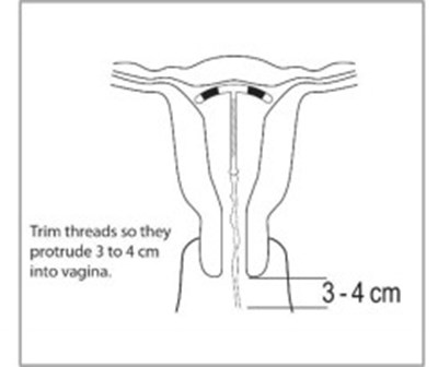 Figure 9 (Par07 0000 09)