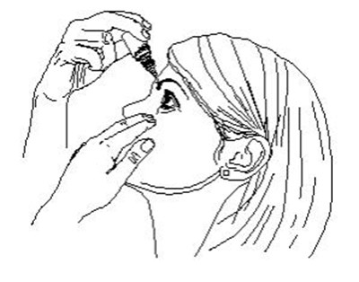 Step 5. Turn Your Dorzolamide Hydrochloride Ophthalmic Solution Dispenser Upside Down And Squeeze Lightly With The Thumb Or Index Finger (as Shown) Until A Single Drop Is Placed In Your Eye. Do Not Touch Your Eye Or Eyelid With The Dropper Tip. See Figure E. (Dorzolamide HCl 7)