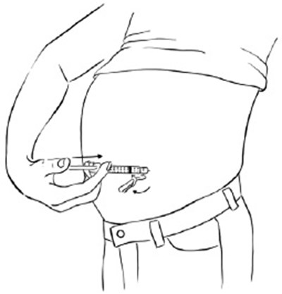 Figure U (Egr00 0001 24)