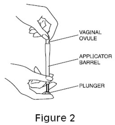 cleocin-ovules-04.jpg Figure 2 - cleocin ovules 04