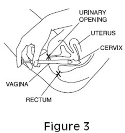 Figure 3 (Cleocin Ovules 05)