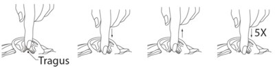 tragus - tragus2