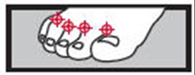 butenafine-01.jpg figure - butenafine 01