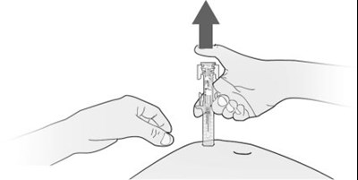 Instructions For Use Figure 09 (Image 11)