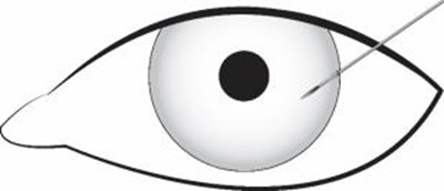 Figure 2 - durysta 02