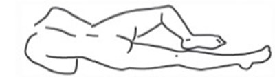 Step 2a Image (Hydrocortisone Rectal Suspension Usp 2)