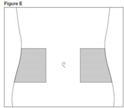 Figure (Eno0i 0000 15)