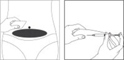 Figure (Cet03 0003 11)