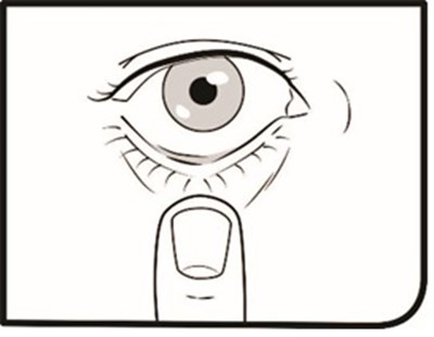 Step 6 (Omlonti Ophthalmic Solution Fig 7)