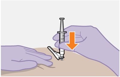 Figure O - apretude spl graphic 21