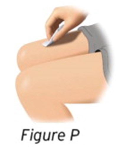 Figure (Ida01 0005 22)