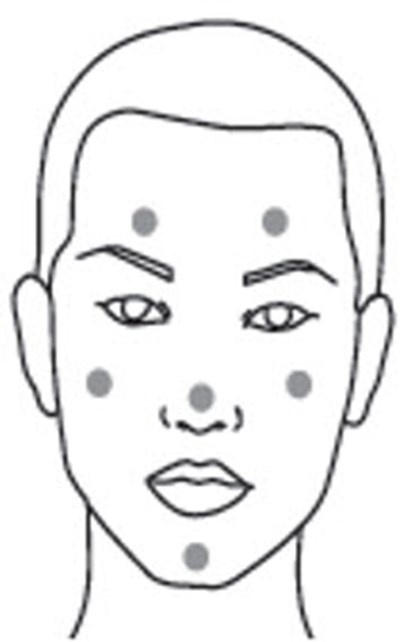 Figure 2 (Clindamycin 04)