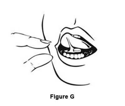 ZOLPIDEM - zolpidem tartrate sublingual tablets 8