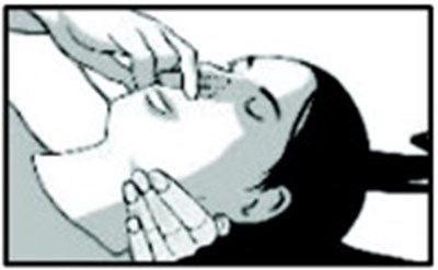 Figure (Narcan 06)