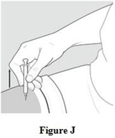 Instructions For Use Figure J (Image 10)