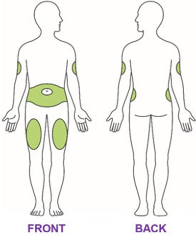 Figure - trulicity ifu 4point5mg injection sites v1