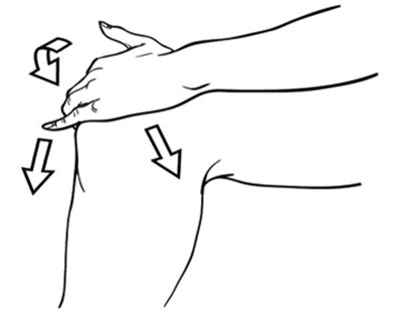 Spreading On Front And Side Of Knee (Figure2)
