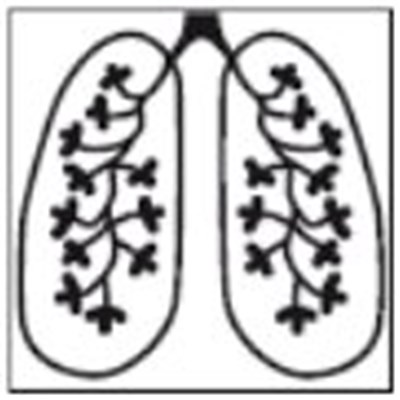 lungs graphic - image 07